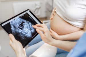 Doctor with an ultrasound scan of unborn child during examination